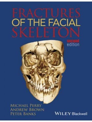 Fractures of the Facial Skeleton