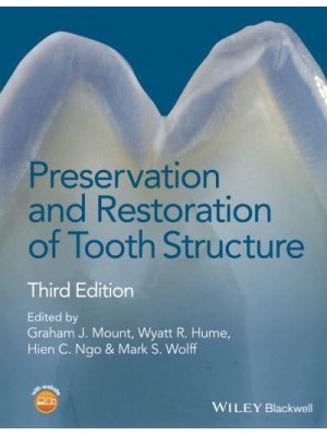 Preservation and Restoration of Tooth Structure