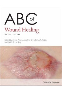 ABC of Wound Healing - ABC Series