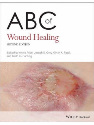 ABC of Wound Healing - ABC Series