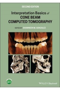 Interpretation Basics of Cone Beam Computed Tomography