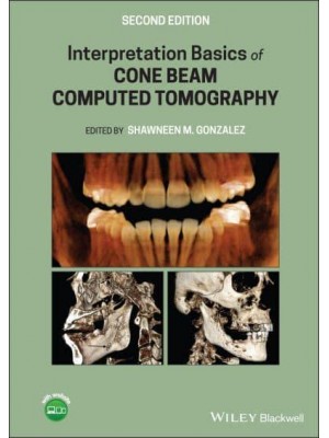 Interpretation Basics of Cone Beam Computed Tomography