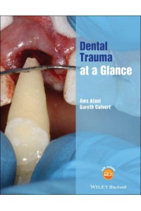 Dental Trauma at a Glance - At a Glance (Dentistry)