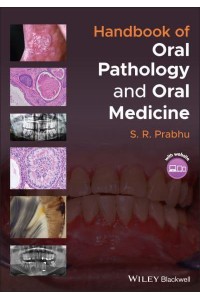 Handbook of Oral Pathology and Oral Medicine