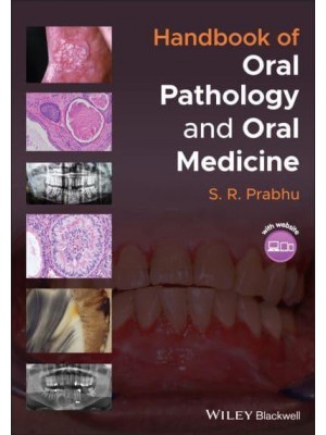 Handbook of Oral Pathology and Oral Medicine