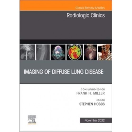 Imaging of Diffuse Lung Disease, an Issue of Radiologic Clinics of North America Volume 60-6 - Clinics: Internal Medicine