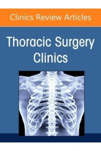 Esophageal Cancer, an Issue of Thoracic Surgery Clinics Volume 32-4 - Clinics: Internal Medicine