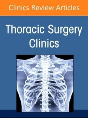 Esophageal Cancer, an Issue of Thoracic Surgery Clinics Volume 32-4 - Clinics: Internal Medicine