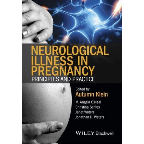 Neurological Illness in Pregnancy Principles and Practice