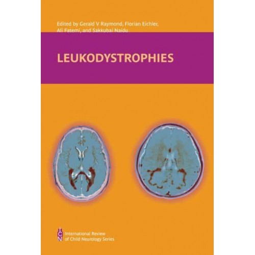 Leukodystrophies - International Review of Child Neurology Series