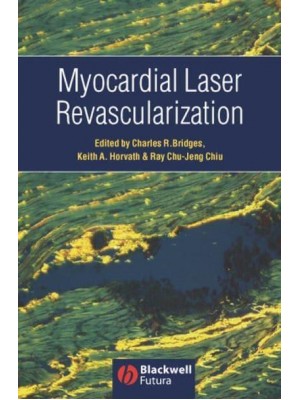 Myocardial Laser Revascularization