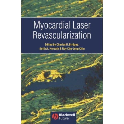 Myocardial Laser Revascularization
