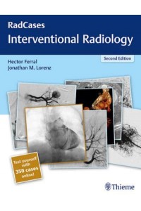 Interventional Radiology - RadCases