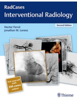 Interventional Radiology - RadCases