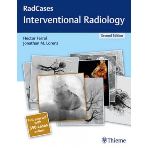 Interventional Radiology - RadCases