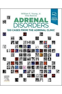 Adrenal Disorders 100 Cases from the Adrenal Clinic