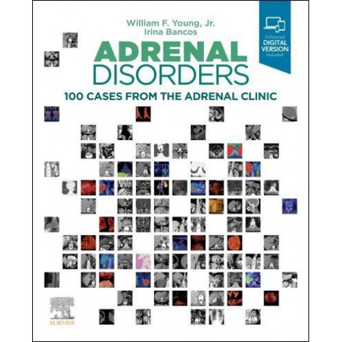 Adrenal Disorders 100 Cases from the Adrenal Clinic