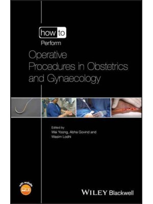 How to Perform Operative Procedures in Obstetrics and Gynaecology - How to Perform
