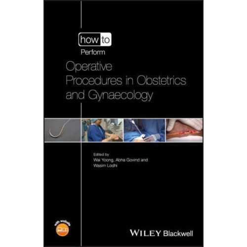 How to Perform Operative Procedures in Obstetrics and Gynaecology - How to Perform
