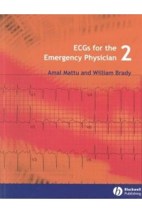 ECGs for the Emergency Physician 2