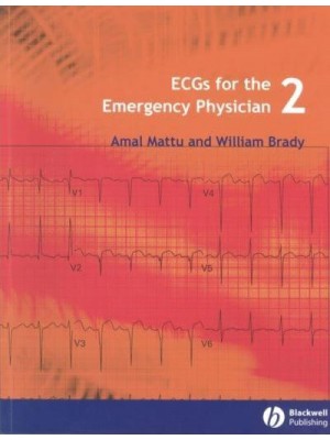 ECGs for the Emergency Physician 2