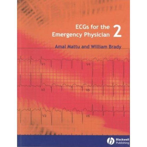 ECGs for the Emergency Physician 2