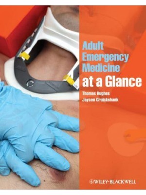 Adult Emergency Medicine at a Glance - At a Glance Series