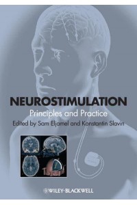 Neurostimulation Principles and Practice