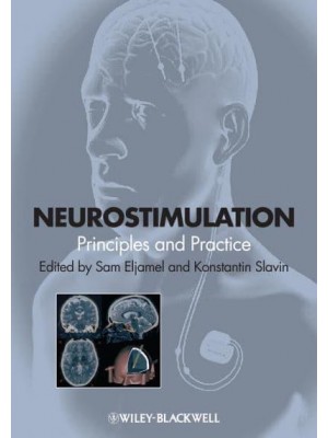 Neurostimulation Principles and Practice