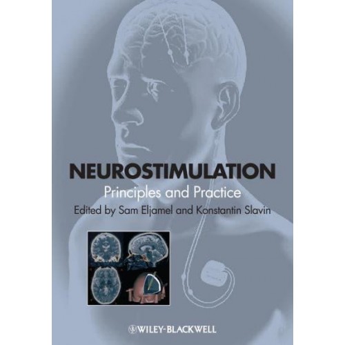 Neurostimulation Principles and Practice