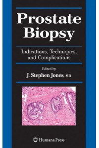 Prostate Biopsy: Indications, Techniques, and Complications - Current Clinical Urology