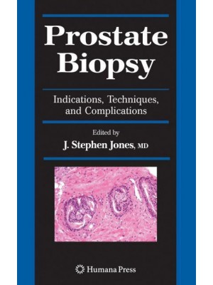 Prostate Biopsy: Indications, Techniques, and Complications - Current Clinical Urology
