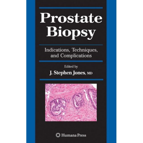 Prostate Biopsy: Indications, Techniques, and Complications - Current Clinical Urology