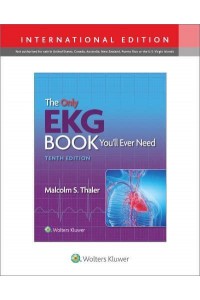 The Only EKG Book You'll Ever Need