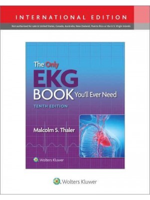 The Only EKG Book You'll Ever Need