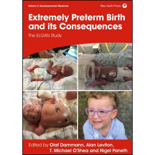 Extremely Preterm Birth and Its Consequences The ELGAN Study - Clinics in Developmental Medicine