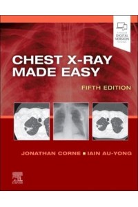 Chest X-Ray Made Easy - Made Easy