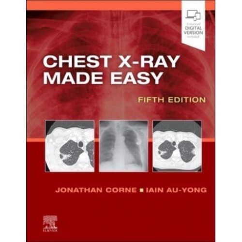 Chest X-Ray Made Easy - Made Easy