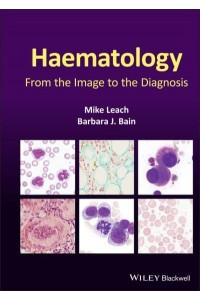 Haematology From the Image to the Diagnosis