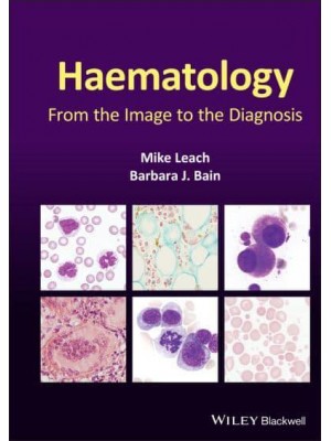 Haematology From the Image to the Diagnosis