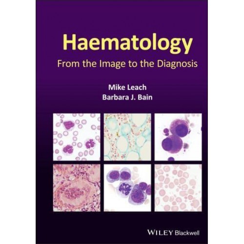 Haematology From the Image to the Diagnosis