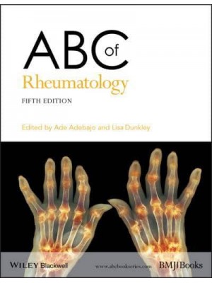 ABC of Rheumatology - ABC Series