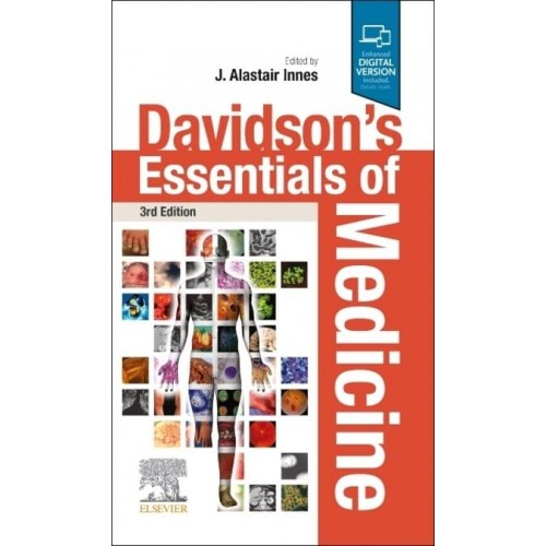 Davidson's Essentials of Medicine