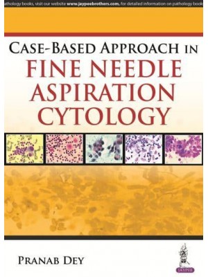 Case-Based Approach in Fine Needle Aspiration Cytology