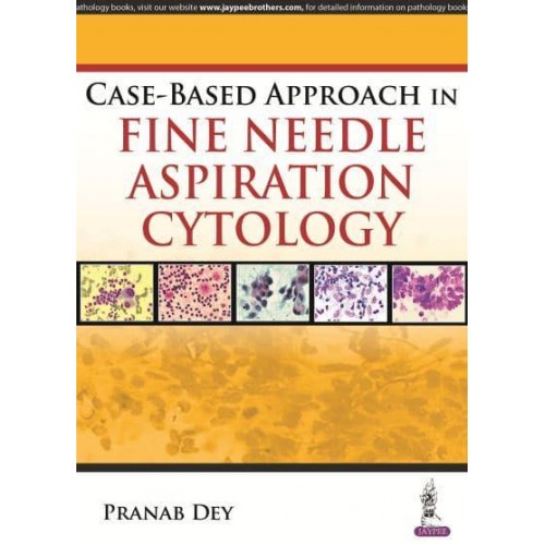 Case-Based Approach in Fine Needle Aspiration Cytology