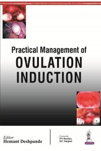 Practical Management of Ovulation Induction