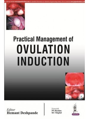 Practical Management of Ovulation Induction
