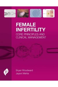 Female Infertility Core Principles and Clinical Management