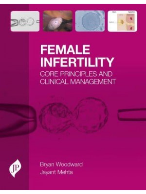 Female Infertility Core Principles and Clinical Management