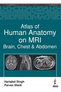 Atlas of Human Anatomy on MRI Brain, Chest & Abdomen